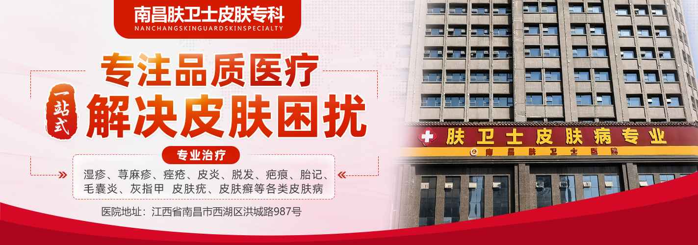 南昌肤卫仕皮肤病医院